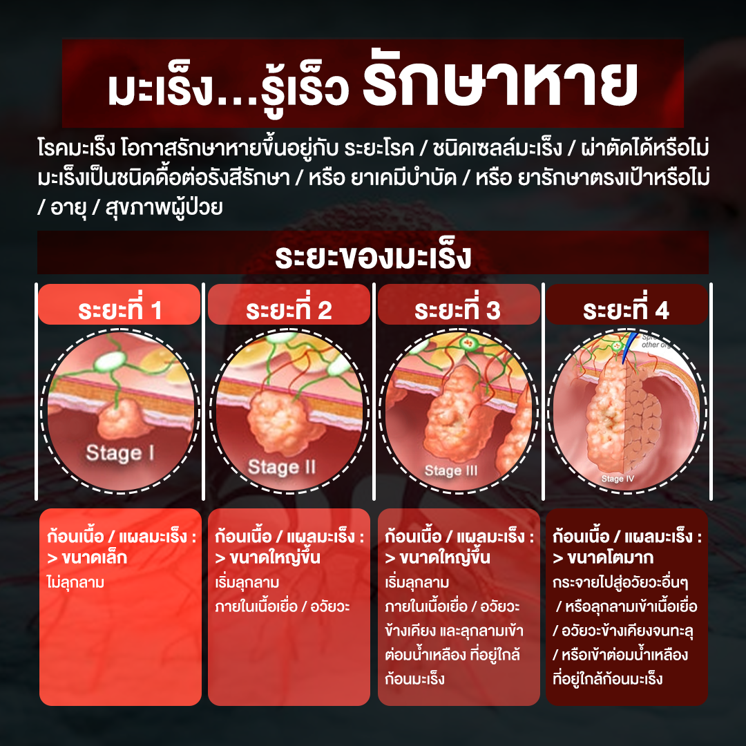 ระยะมะเร็ง