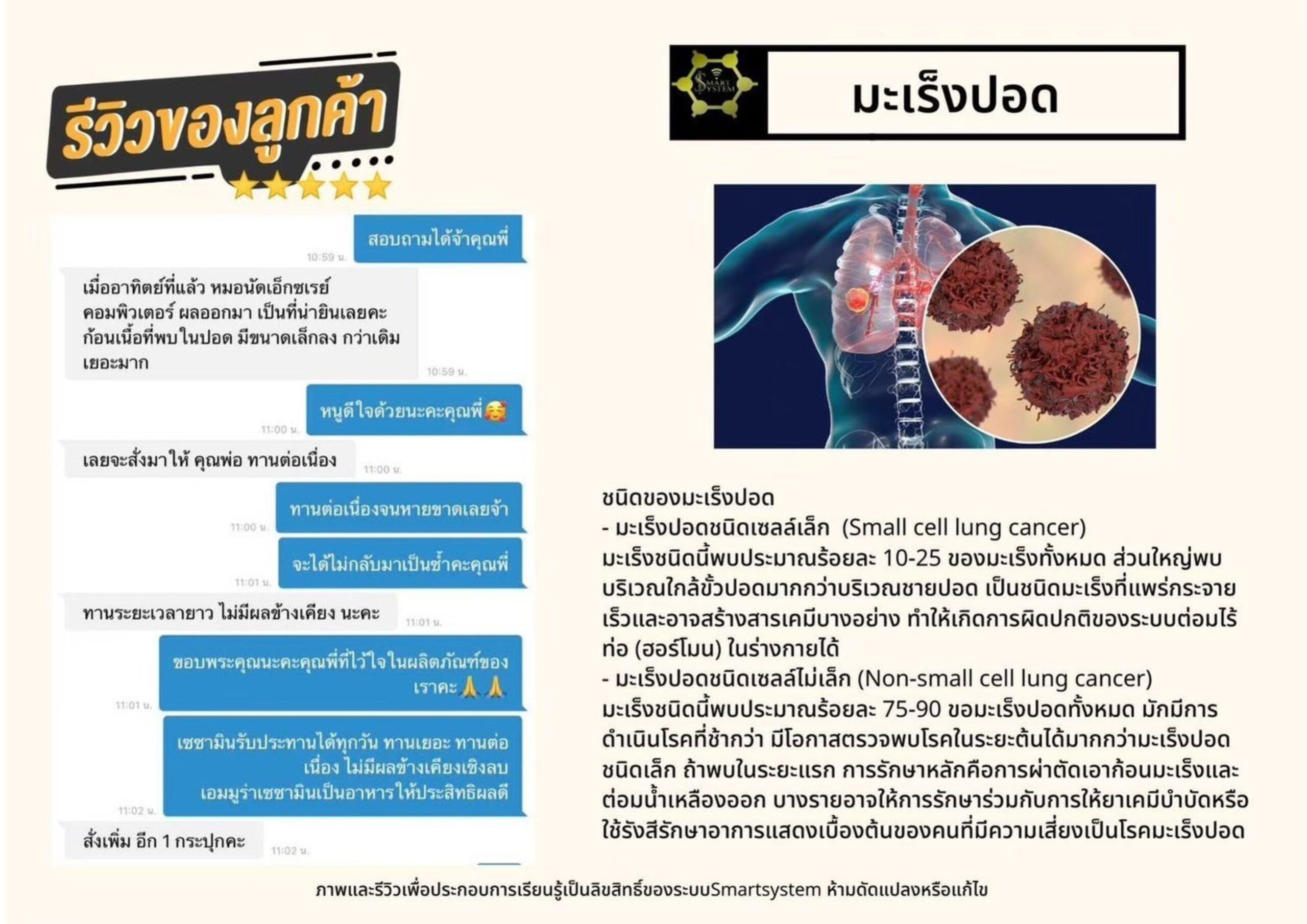 มะเร็งปอด