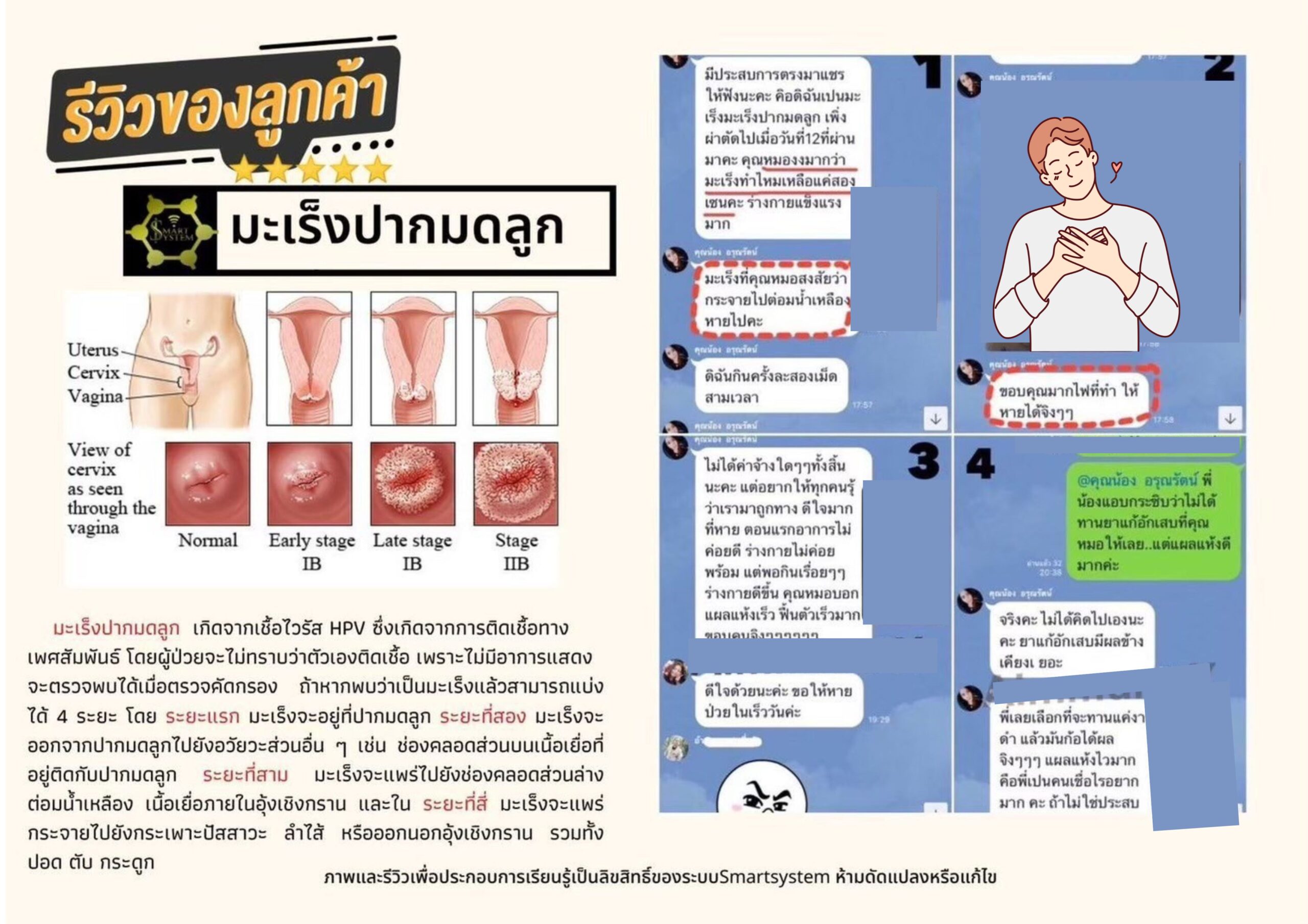 มะเร็งปากมดลูก