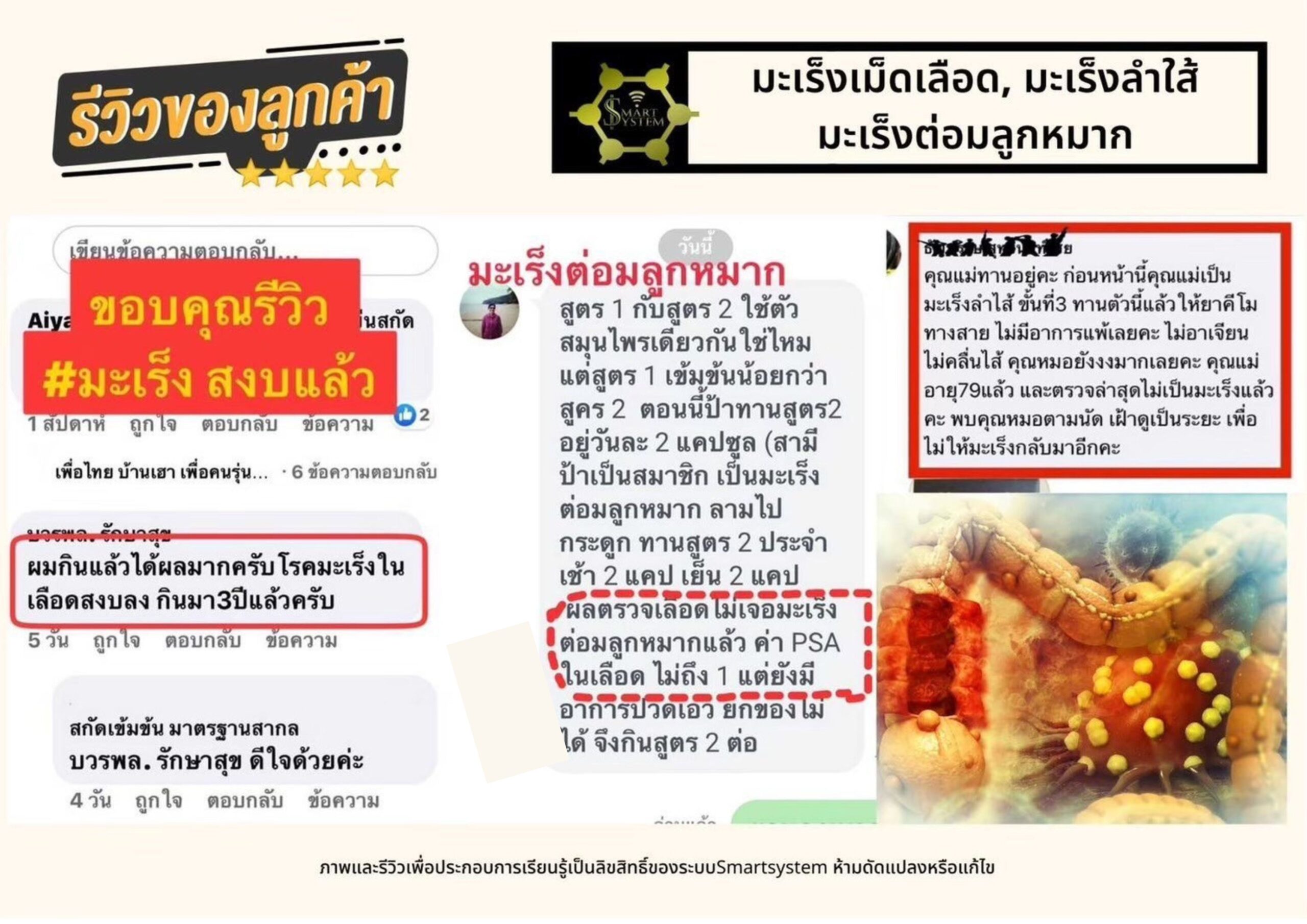 มะเร็งเม็ดเลือด