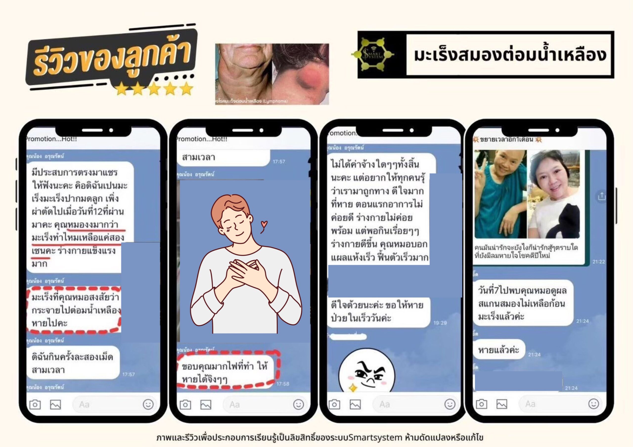 มะเร็งสมอง